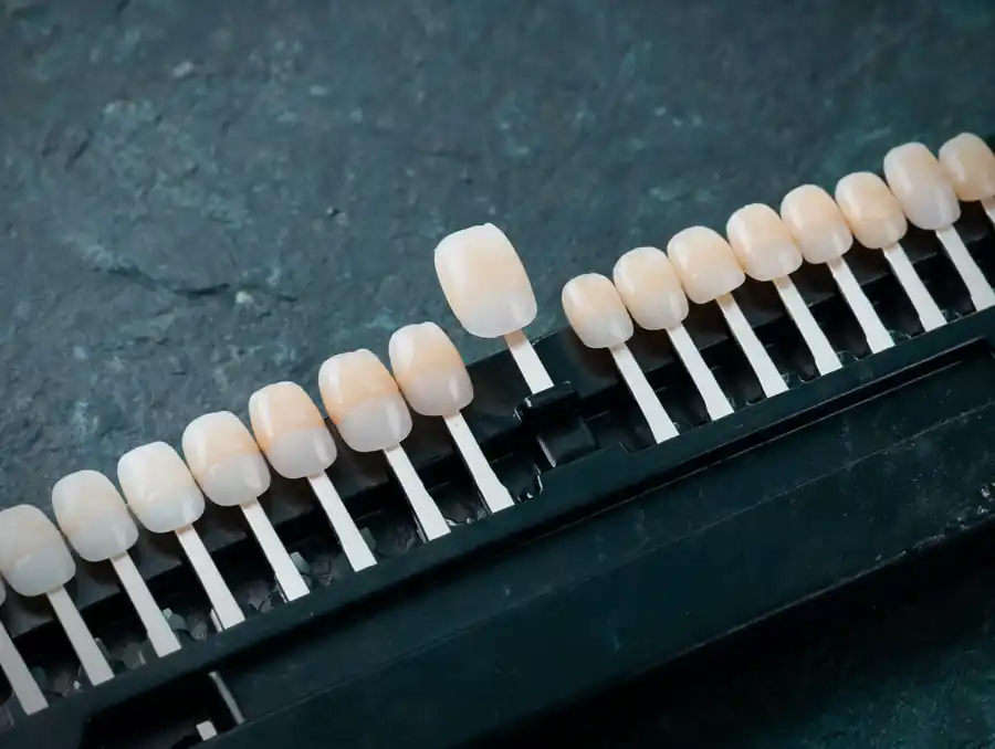 Guía de colores dental abierta con una pestaña de cerámica levantada